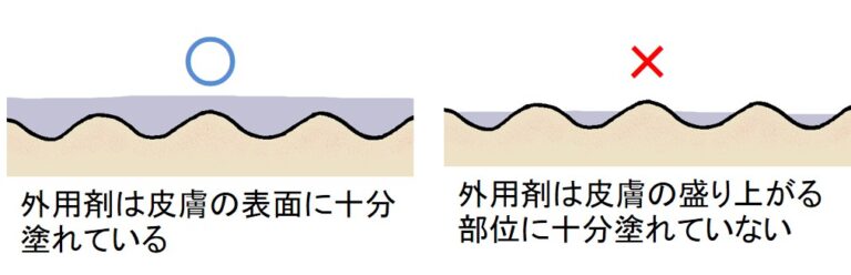 外用薬の塗り方