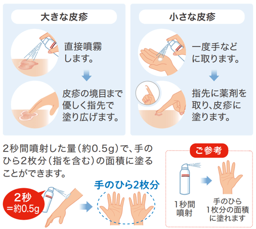 ドボベットフォームの使用法の画像
